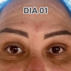 Serum Anti-Aging™ Colágeno, Niacidamida + Masajeador InfraColor